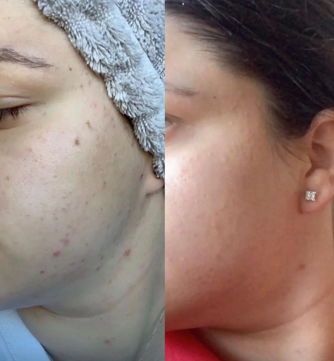 BEFORE & AFTER